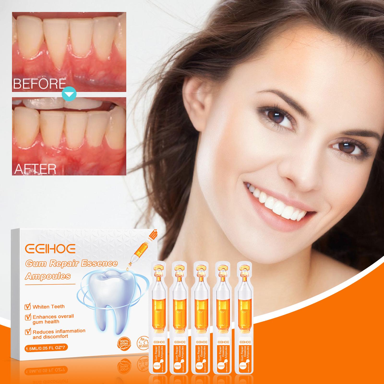 Teeth Repair Deep Cleaning Teeth Yellow Teeth Stain Tartar Care Gum Oral Care 10