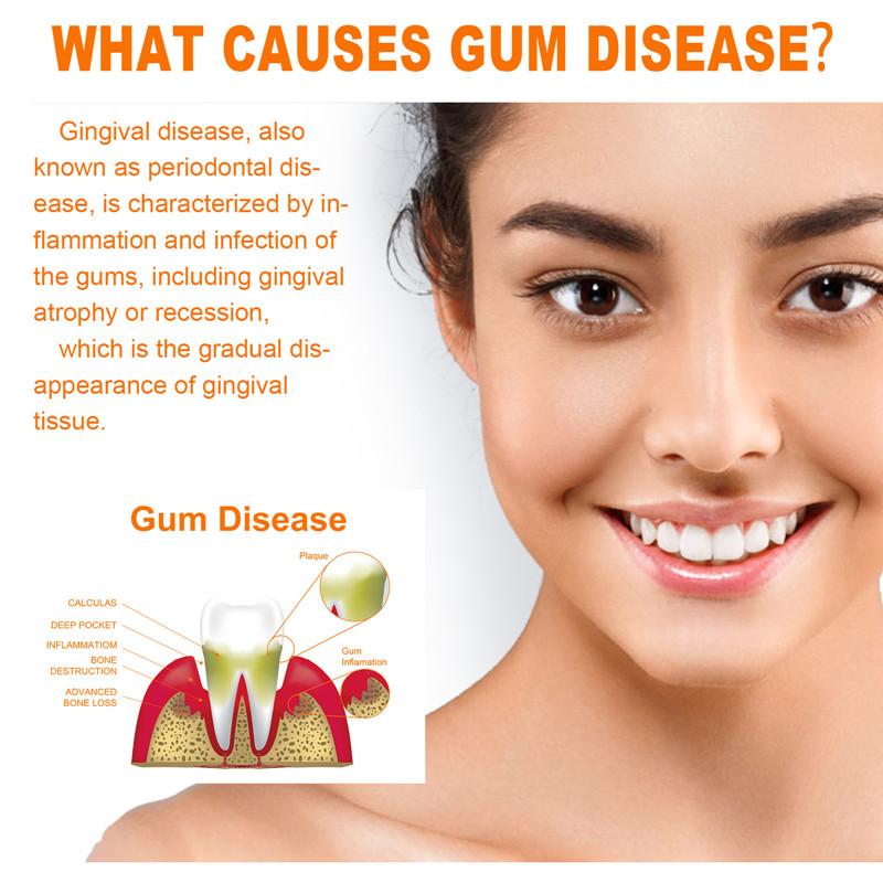 Teeth Repair Deep Cleaning Teeth Yellow Teeth Stain Tartar Care Gum Oral Care 3